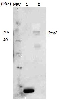 FtsZ2 | Plant cell division protein ftsZ2 in the group Antibodies Plant/Algal  / Developmental Biology / Cytoskeleton at Agrisera AB (Antibodies for research) (AS13 2651)